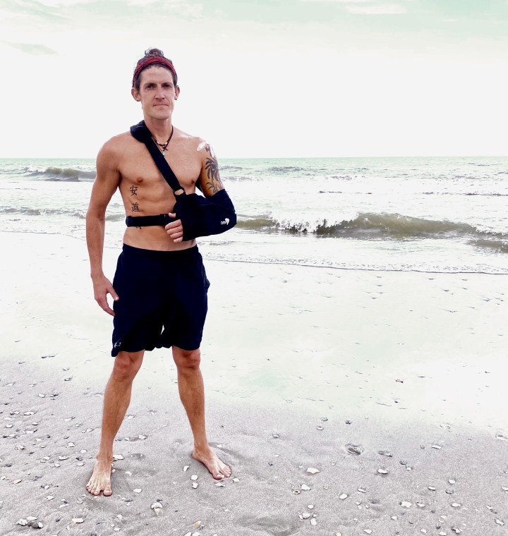 Rotator Cuff Surfing Injury, Part 2 of 2: Post-Op Healing&nbsp;Regimen